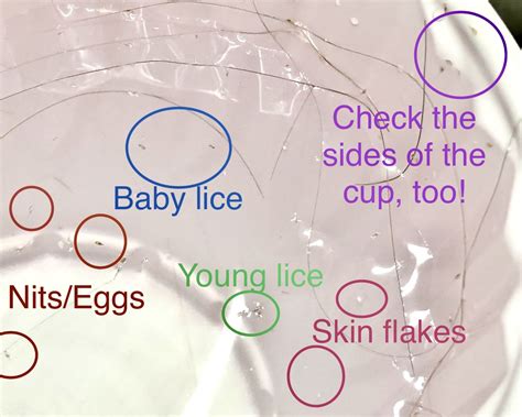 How To Check Myself For Lice