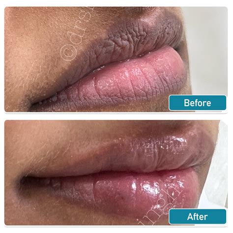 Best Skin & Hair Clinic Surat | Advanced Skin & Hair Treatment In Surat ...