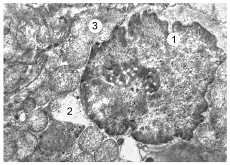The Role of Lyophilized Xenodermotransplants in Repairing the Atria’s ...