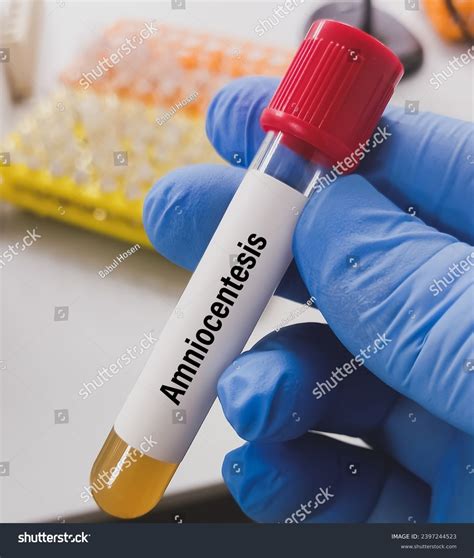 Amniocentesis Amniotic Fluid Test Test Done Stock Photo 2397244523 | Shutterstock