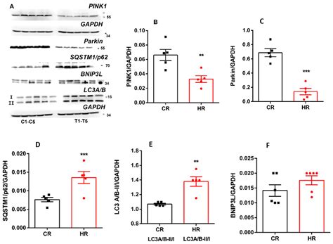 Structural and Dynamic Features of Liver Mitochondria and Mitophagy in ...