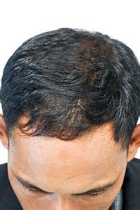 Kaya’s Hair Care PMP