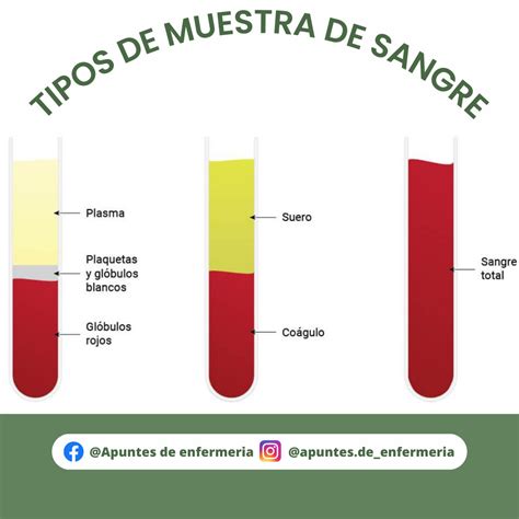 Tipos de Muestra de Sangre