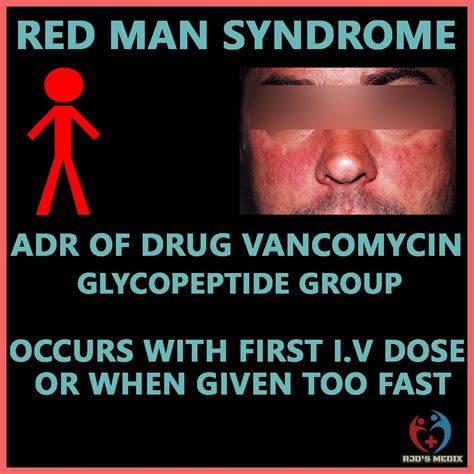 What Is The Medical Term For Red Man Syndrome at Jai Patrick blog