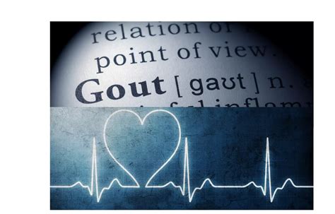 Allopurinol may increase CV risk, mortality in gout compared to ...