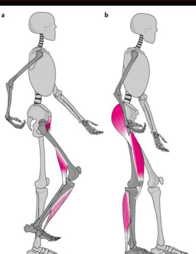 Image result for Contralateral Gait