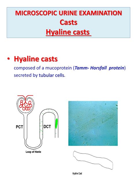 PPT - Urine Analysis PowerPoint Presentation, free download - ID:2139443