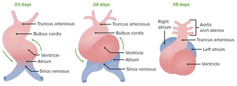 Image result for Heart Development Disorders