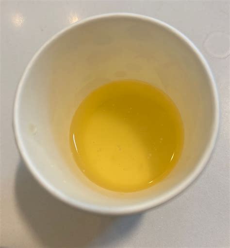 TMI photo- white specks in urine? | BabyCenter