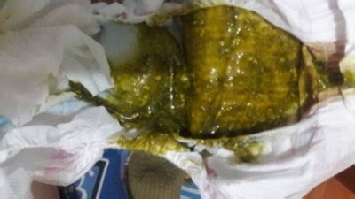 5 razones por las que el popó del bebé viene verde | BabyCenter