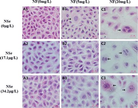 Histopathological changes in NRK-52E cells exposed to NaF and Na2SeO3 ...