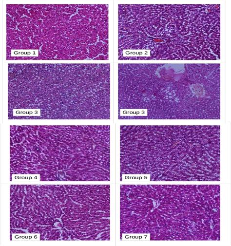 Fig. 9: Histopathlogical changes in the liver (representative images ...