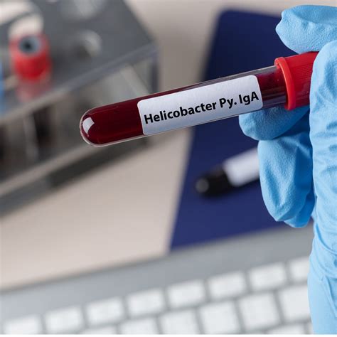 Helicobacter Pylori IgA, Helicobacter Pylori IgA nedir - Güvenli Test Merkezi
