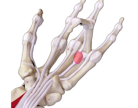 Trigger Finger-causes, symptoms and treatments | Orthopaedics Corner | Health Corner | Asia ...