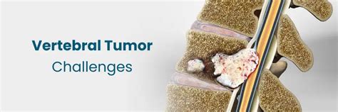 Kwararrun Kula da Ciwon Ciwon Jiki a Vizag