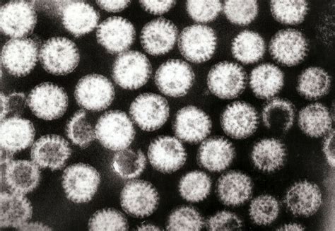 RTI Data Reveals Diarrhoea as Top Health Issue in Delhi, Over 5 Lakh ...