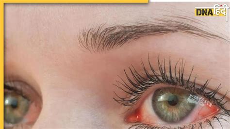 Red Eyes Latest News and Updates in Hindi – Red Eyes के समाचार,ताज़ा ...