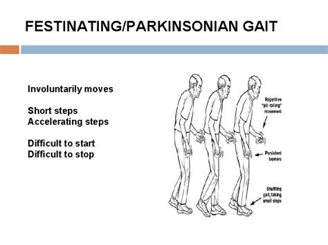 Image result for Contralateral Gait