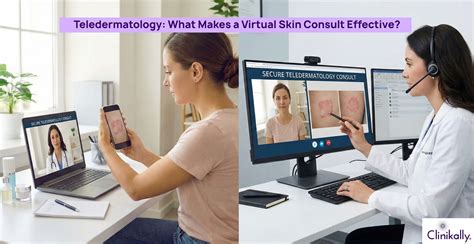 Teledermatology Guide: Benefits, Process & Online skin Consultations