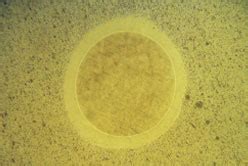 SURFACE MODIFICATION TECHNOLOGIES