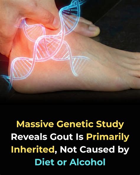 New Genetic Study Uncovers Surprising Truth About Gout: It's Not Just Caused by Diet
