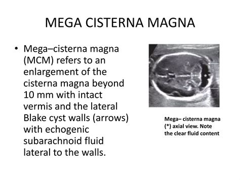 Fetal anomaly scan | PPTX