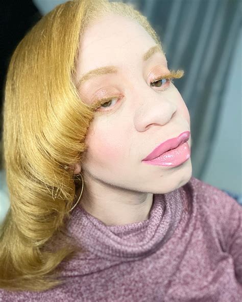 Beautiful Albino Black People