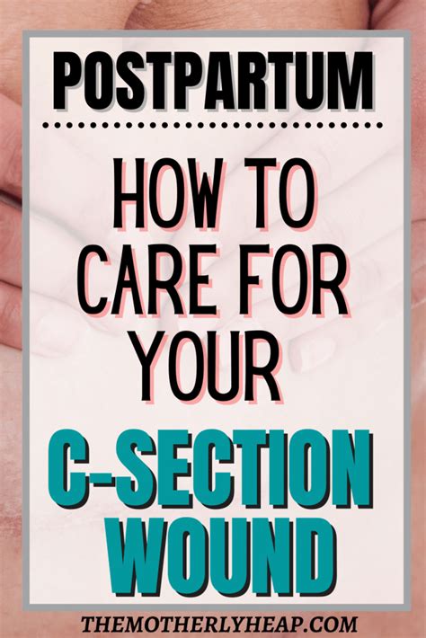 C-Section Wound 的图像结果