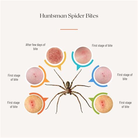 Huntsman Spider: Size, life cycle, Bit, and other facts.
