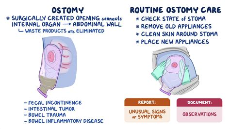 Colostomy Care Procedure