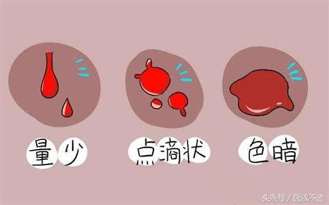 孕早期出血的三种原因解析，是否先兆流产根据颜色判断 - 柚喜问答