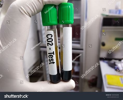 112 Potassium K Test Images, Stock Photos & Vectors | Shutterstock