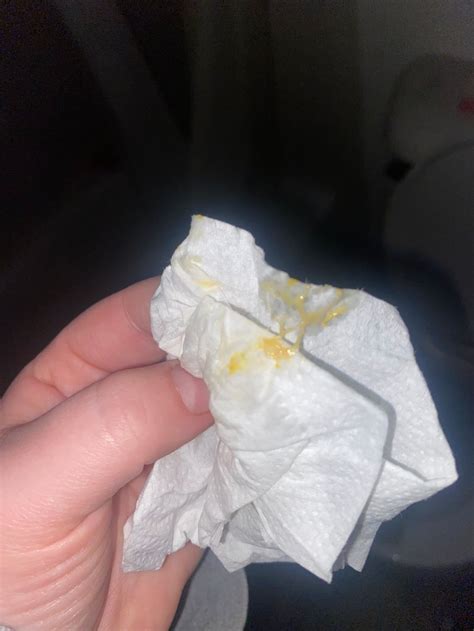 Yellowish Discharge In Early Pregnancy