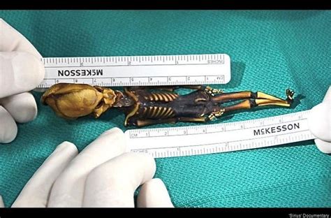 Image result for Alien Baby Belly Babies so Active