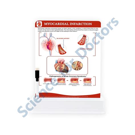 Myocardial Infarction: 1 Slide on stand – SMS Scientific Products Pvt. Ltd.