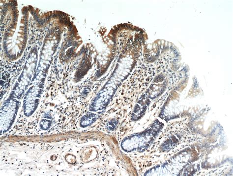 HPDL antibody (20777-1-AP) | Proteintech