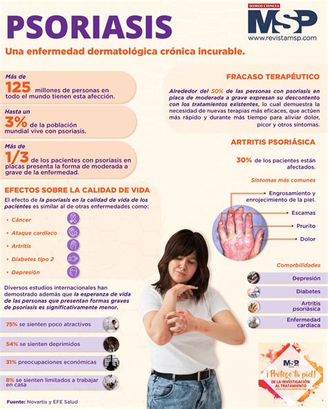 La psoriasis - infografía