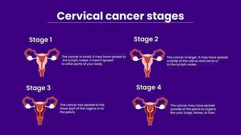 Lesion Of Cervix _ Cervical cancer – NXVRGK