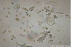 tappeto di emazie epithelial cells tappeto di emazie epithelial cells