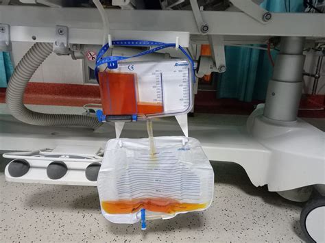 Measurement Of Urinary Output