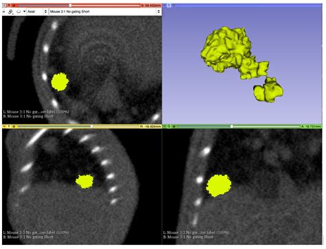 Image result for 3D Slicer Segmentation Tutorial