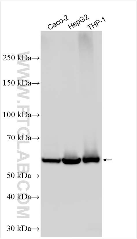 CES1 antibody (29041-1-AP) | Proteintech