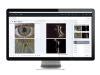 ZEISS SL Imaging Solution | ZEISS Medical Technology