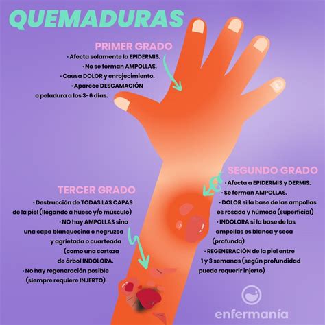 Quemaduras De Primer Grado: Síntomas Y Tratamiento – CKXK