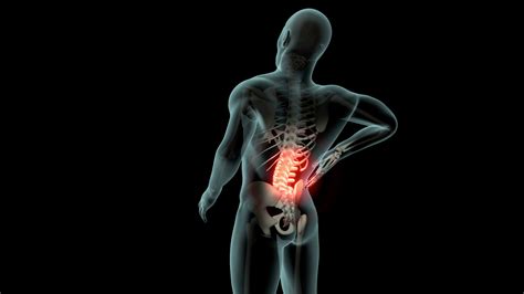 Sciatica Back Pain: Risk Factors, Symptoms, Diagnosis & Treatment : Five Dock Osteopathic ...
