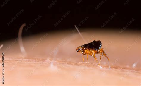 Flea 的图像结果