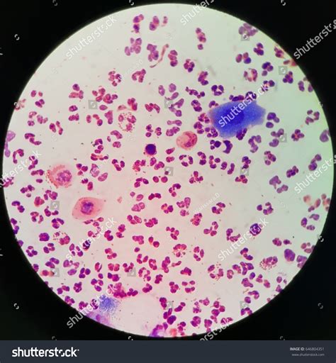 Gram Negative Diplococci Neutrophils Stained By Stock Photo 646804351 ...