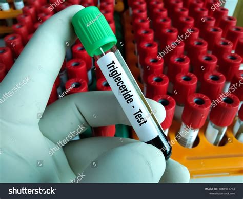 Tube Color For Triglycerides at Jean Tunstall blog