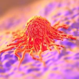 Image result for Cancer Detection Using Graph CNN