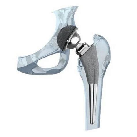 Joint Prosthesis - A.M. Hip Prosthesis Manufacturer from Vadodara